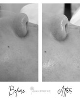 サロン コムモア(salon COMME MOI)/BeforeAfter