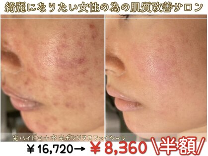 アリュール 倉敷(ALLURE)の写真