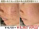 アリュール 倉敷(ALLURE)の写真