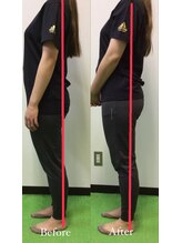 リトラ(Retra)/整体・BeforeAfter