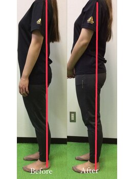 リトラ(Retra)/整体・BeforeAfter