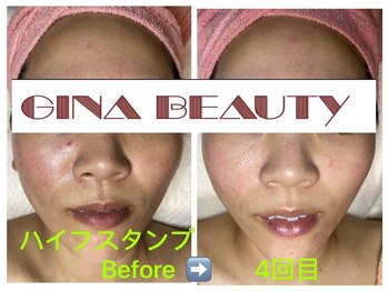 ジナ ビューティ(GINA BEAUTY)/