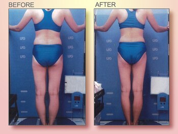 ジュリア オージェ 梅田店/ビフォーアフター(エンダ)