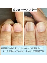桃の木 吉祥寺店/自爪育成は時間がかかります