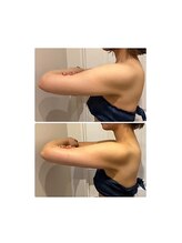 ルナグランデ 心斎橋店(Luna grande.)/着たい服が着れる