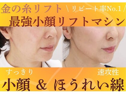 ミーティア(Meteor)の写真