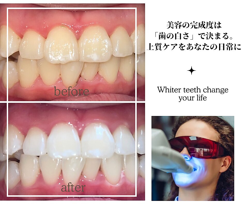 グリンプラス(grin+)｜ホットペッパービューティー