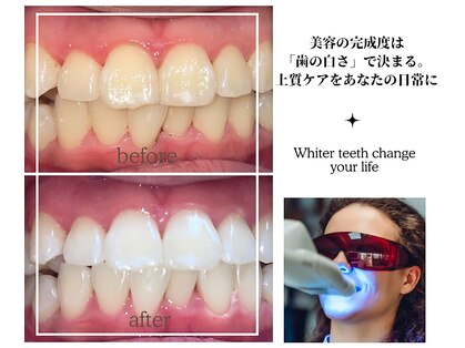 グリンプラス(grin+)の写真