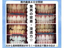 ホワイトニングショップ 明石大久保店の雰囲気（1来店で3～6トーンアップ。一人一人に合ったプランをご案内♪）
