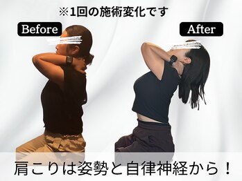 ハリユナイテッド 原宿鍼灸 整体院(HALI UNITED)/肩こりは姿勢と自律神経から!