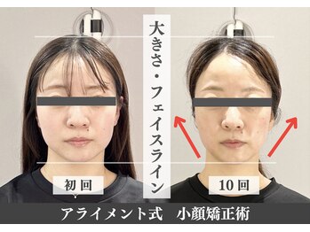 アライメントトウキョウ 表参道(Alignment TOKYO)/ブライダル美容整体 10回後