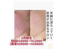 ラウレア(Laule’a)