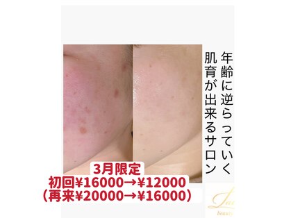 ラウレア(Laule’a)の写真