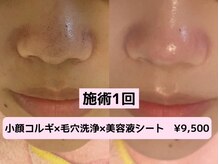 ライゼ(REISE)の雰囲気（確かな技術と素肌への思いやりで、まだ見ぬ自分へ会いに行く。）