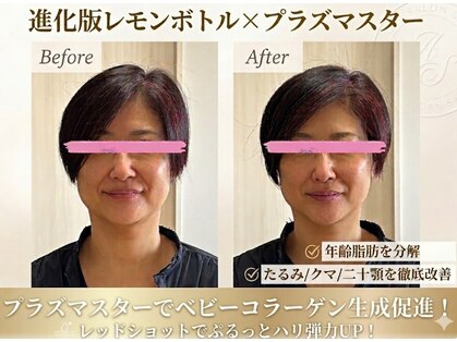 シュシュ(Chouchou)の写真