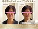 シュシュ(Chouchou)の写真