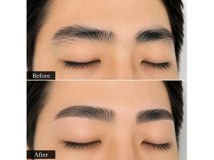 スムース ホワイトニング(SMOOOTH WAX)の写真