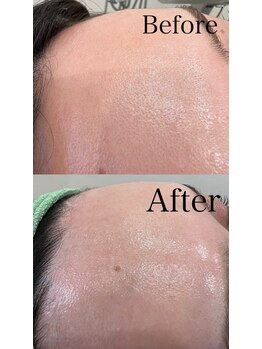 グランド ビューティー ビーズ 半田店(Grand Beauty B's)/シェービング