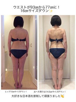 ホロニック ベルサンテ(Holonic Belle Sante)/メディセルハイブリッド