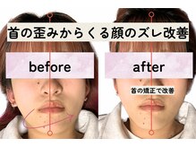 男女問わずご利用頂けます。小顔/肩こり/痩身/リンパ/ヘッド