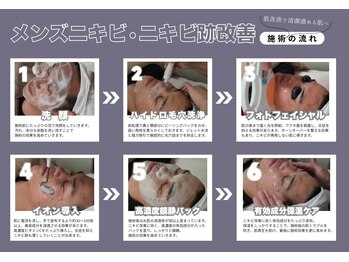 ビズビズ 梅田店(bisebise)/メンズ本気ニキビ改善増えてます