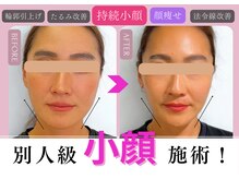 ヴィヴィアナ(viviana)の雰囲気（骨盤矯正と小顔でお悩みに沿ったカウンセリングを♪）