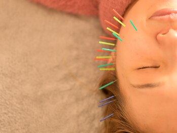 アロエベル(aloe Belle)/美容鍼