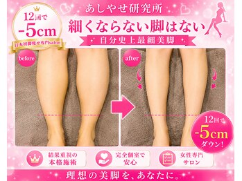 メディカルエステ 大宮店/※痩身症例写真※ 痩身/痩身
