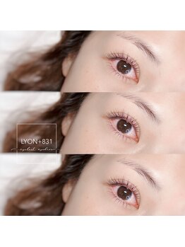 リヨン(LYON+831)/