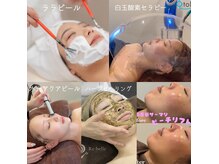 エスポワ