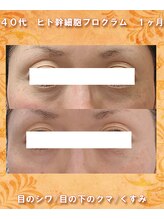 ナイア(naia)/ヒト幹細胞プログラム症例