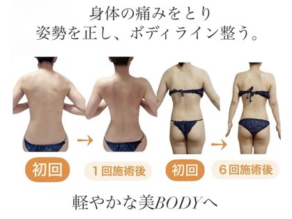 リュミエール(umiere)の写真