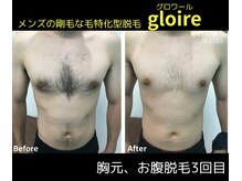 グロワール(gloire)の雰囲気（大人気☆抜け感抜群！メンズ全身脱毛で清潔感のあるボディへ♪）