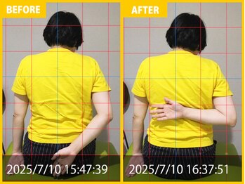 整体院 元 宇城松橋店/頭痛、首肩の悩み