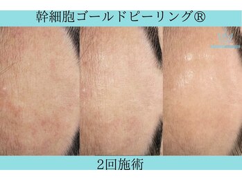 リメイク 広尾(REMAKE)/