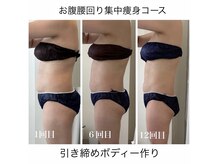 ラヴィ(Ravi)の雰囲気（お腹・腰回り集中痩身コース60分）