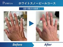 ピュアラ 心斎橋店/手肌美人の冬習慣。