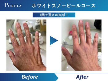 ピュアラ 心斎橋店/手肌美人の冬習慣。