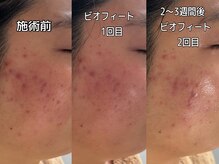 ジュメーム サンテ エ ボーテ(Je m'aime sante' et beaute')の雰囲気（ダウンタイムなしビオフィート）