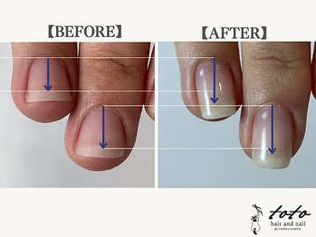 トトヘアー アンド ネイル(toto hair and nail)/【toto式】自爪育成 貝爪改善