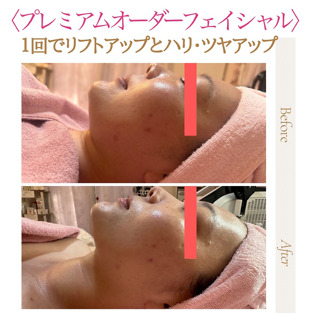 ポムポムボナー｜ホットペッパービューティー