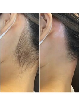 やまとなでしこ 中野店/うなじWAX