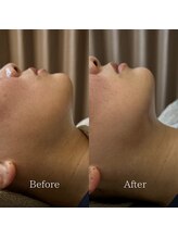 こころととのう/顔コリほぐし