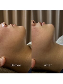 こころととのう/顔コリほぐし