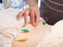 晴(ハレ)/鍼とパルス