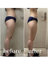 レイビス 郡山店(RAYVIS)/セルトリ