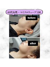 グランディールアン(GRANDIR UN)/たった20分で脱二重あご