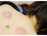 【痛み・不調改善】 お身体の鍼灸（全身調整）90分～ ￥12,000→10,000