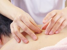 晴レヤカ鍼灸治療院の雰囲気（強い刺激が無くとも全身が整う実感）