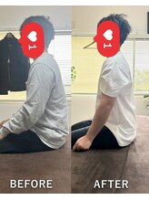 生駒の丘神経整体院/睡眠時の首の痛みで眠りが浅い